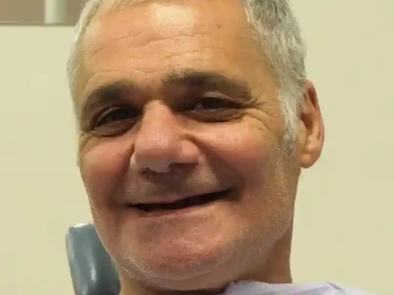 smiling teeth