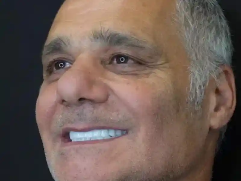 smiling with twisted teeth set