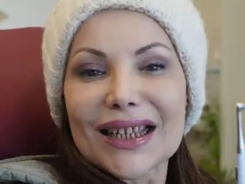 smiling teeth
