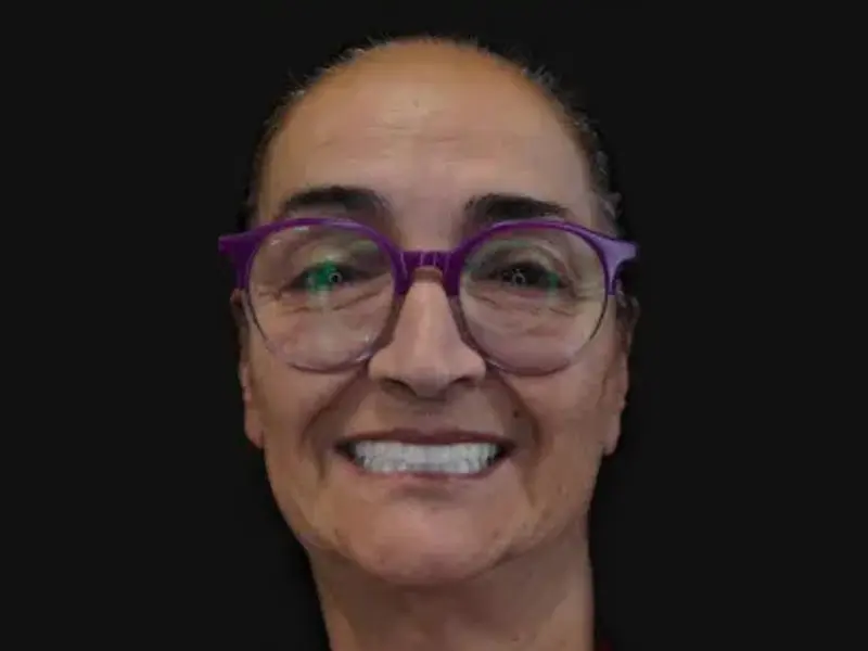 smiling with twisted teeth set