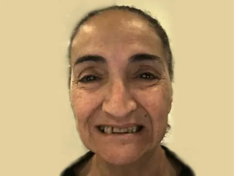 smiling teeth